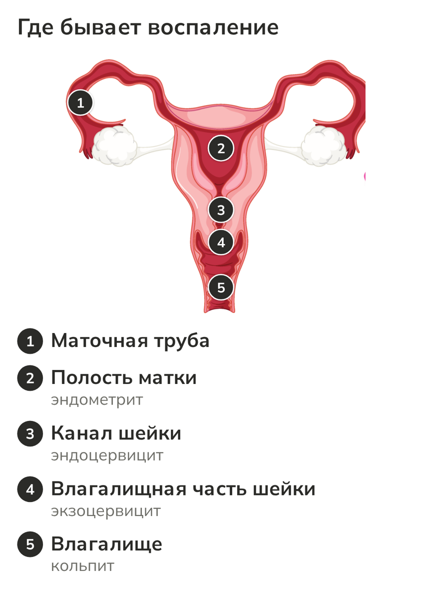 Шейка матки в разрезе и вид наружного зева в зеркалах