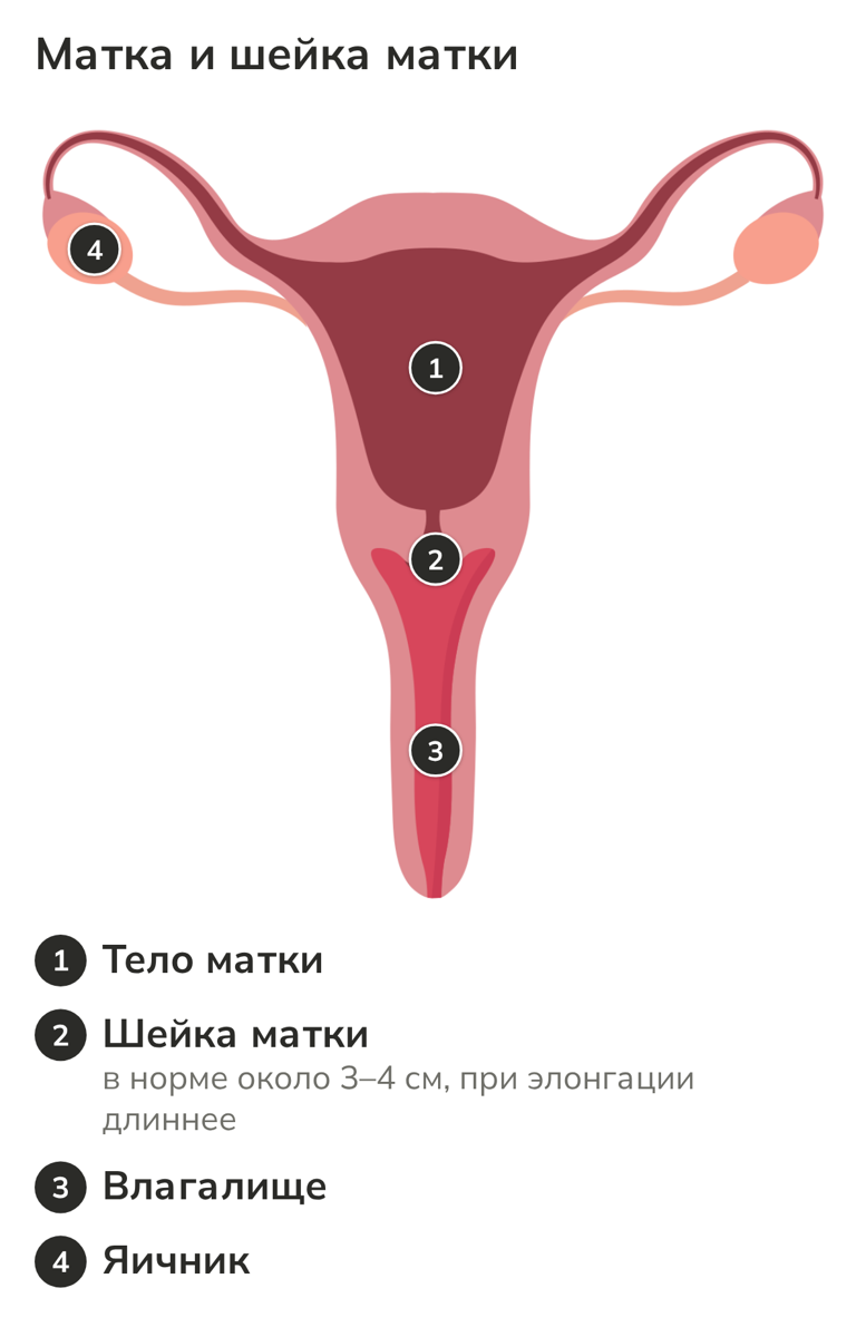 Схема матки и шейки матки