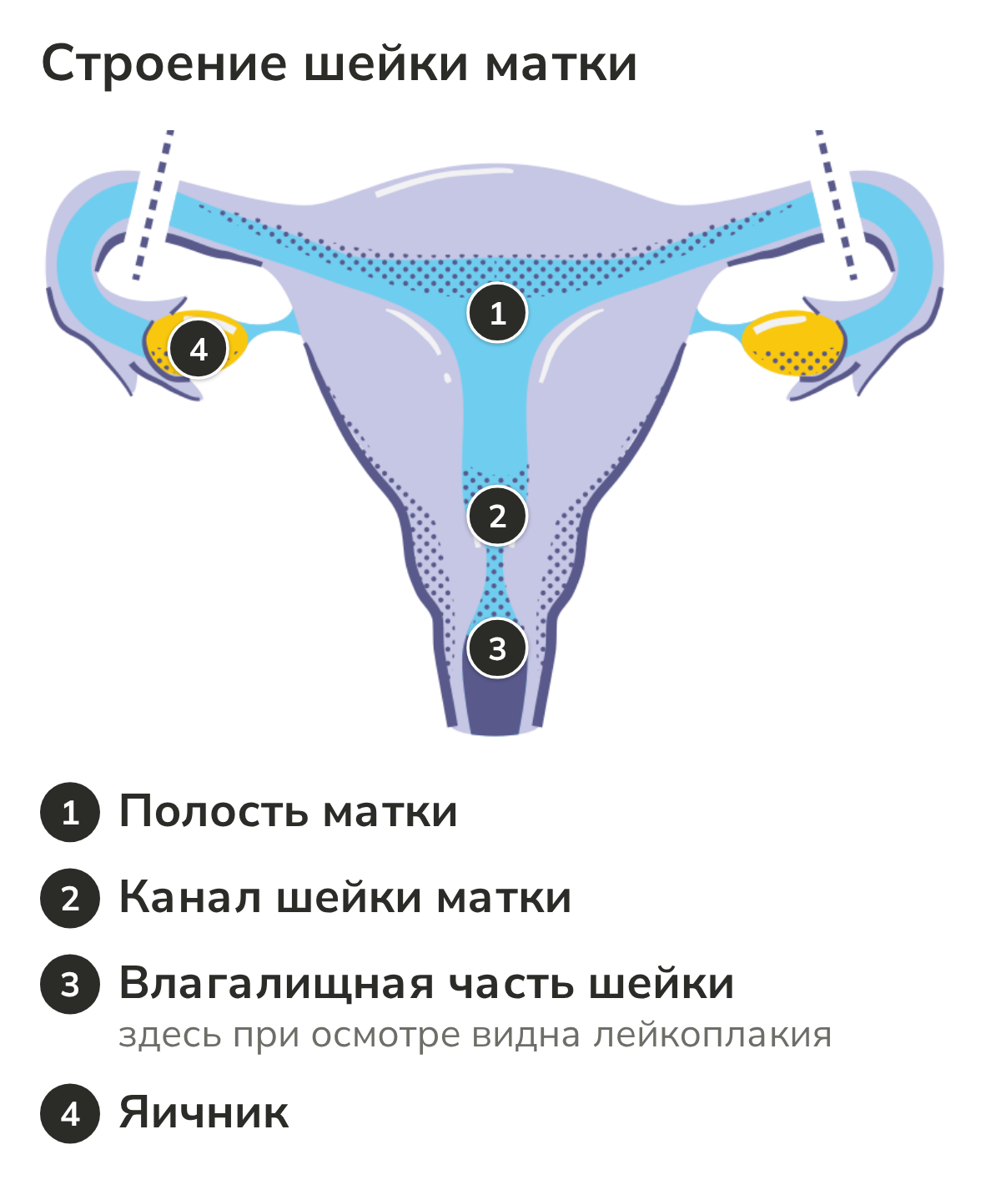 Строение матки и шейки матки: полость, канал шейки, влагалищная часть шейки