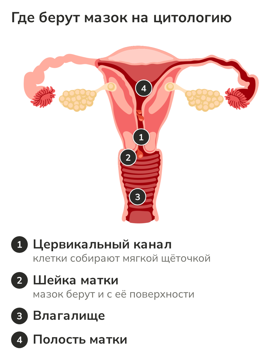 Анатомическая схема: матка, шейка матки, цервикальный канал, влагалище